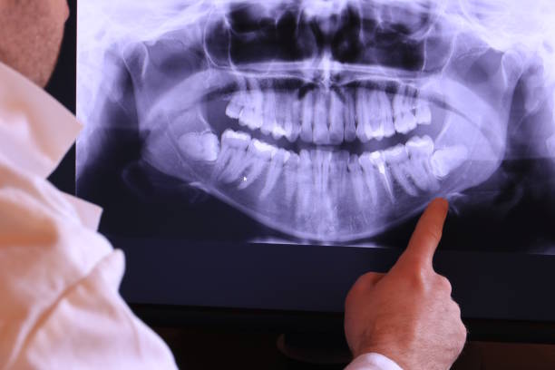 Best Emergency Denture Repair in Meridian, TX