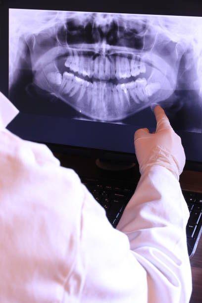 Best Urgent Care for Lost Fillings or Crowns in Meridian, TX